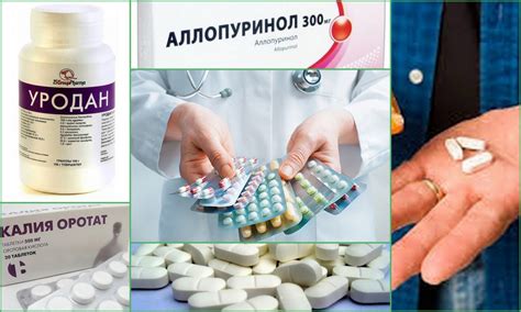Какие лекарства могут снизить уровень мочевой кислоты