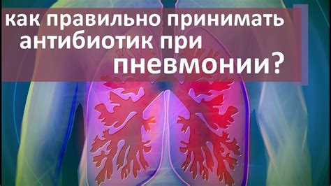 Какие лекарства назначаются при пневмонии: