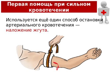 Как определить оптимальное место прижимания при артериальном кровотечении