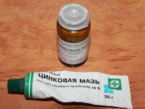Мази от потницы - выбор средств для лечения