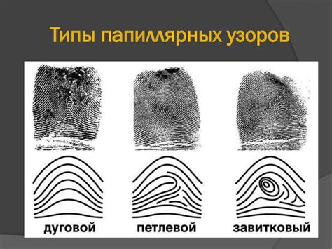 Механизмы предотвращения зажатия пальцев
