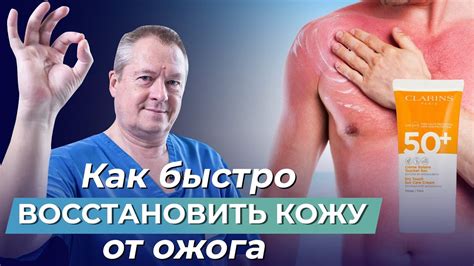 Ожоги от солнца: что взять в отпуск на море