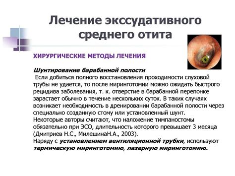 Примеры препаратов для лечения воспаления наружного уха