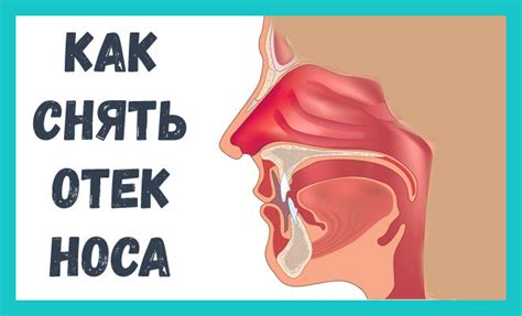 Что такое отек носа