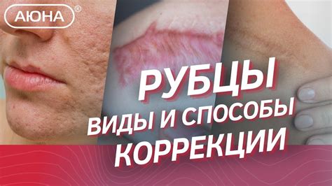 Важные факторы, влияющие на формирование рубцовых изменений на коже спины