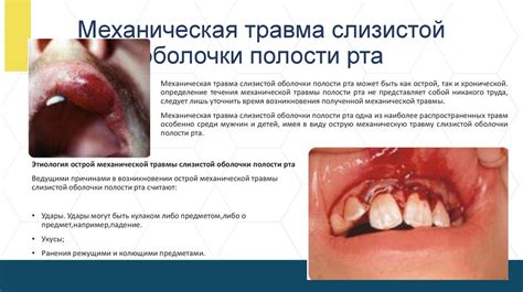 Влияние пищевых аллергенов на развитие длительного воспаления слизистой полости рта у детей