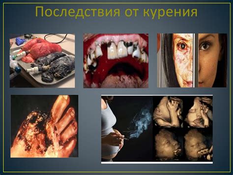 Влияние постуральных привычек на выражение челюсти