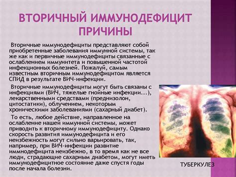 Вторичный иммунодефицит: основные сведения