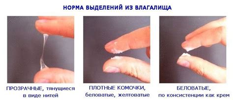Гнойный запах выделений у женщин