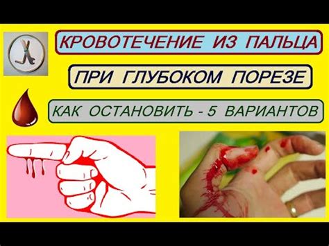 Действия при глубоком порезе подушечки пальца