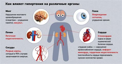 Диагностика и обследование гипертонии глаза