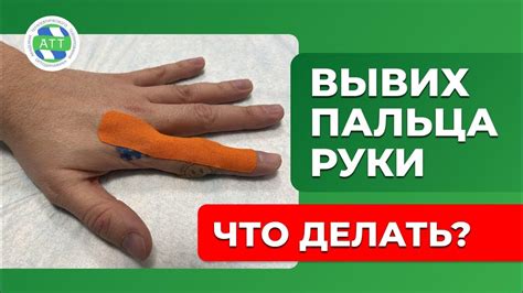 Домашние способы улучшения состояния при повреждении сустава пальца на руке