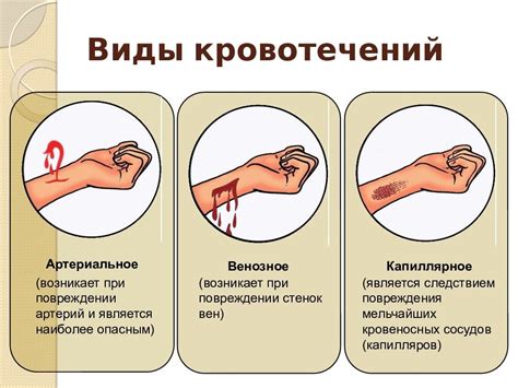 Использование хирургического клея для эффективной остановки кровотечения у домашней питомцев