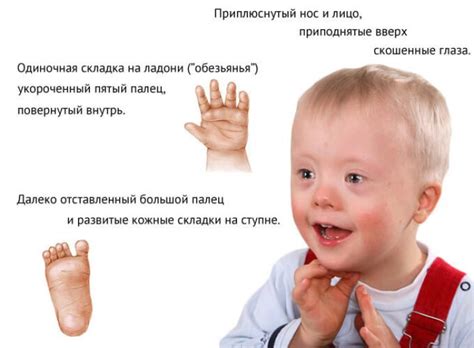Исследование и оценка состояния здоровья ребенка для определения синдрома Дауна