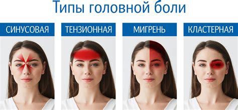 Кластерная головная боль