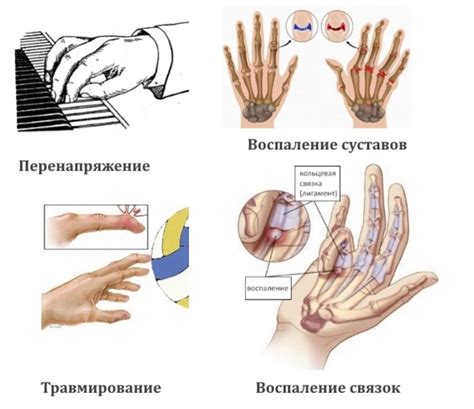 Когда обратиться к медицинскому специалисту после повреждения сустава на пальце руки