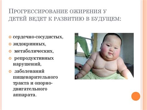 Не только проблема ожирения: наследственность, возраст и другие факторы