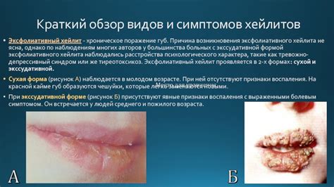 Обзор причин возникновения голубизны губ у малыша