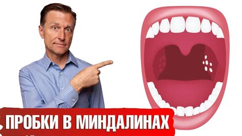 Осложнения при наличии гнойных шариков на гландах