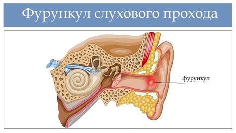 Основные признаки образования пробки из остатков влаги в слуховом канале