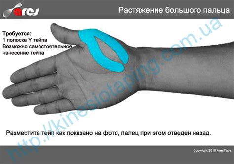 Первичная помощь при получении травмы сустава пальца на руке: как справиться с ситуацией