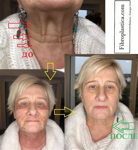 Поддержание здоровья кожи шеи: важность избегания загрязненных и переполненных мест