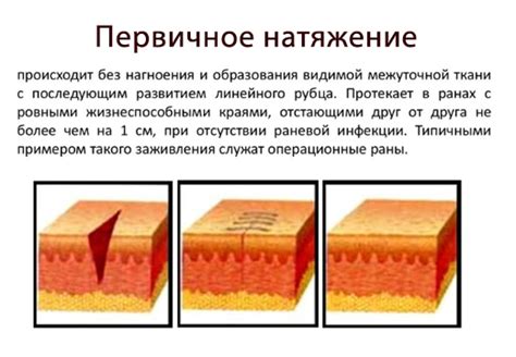 Применение локальных средств для активации процесса заживления