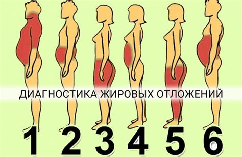 Принципиальные факторы накопления жировых отложений на областях спины