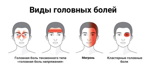 Причины головной боли