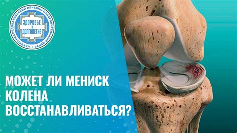 Причины дегенеративных изменений менисков коленного сустава