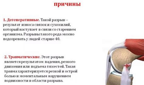 Причины и проявления растяжений щиколоточных связок: разбор симптомов
