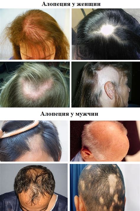 Причины потери блеска у волос и методы их предупреждения