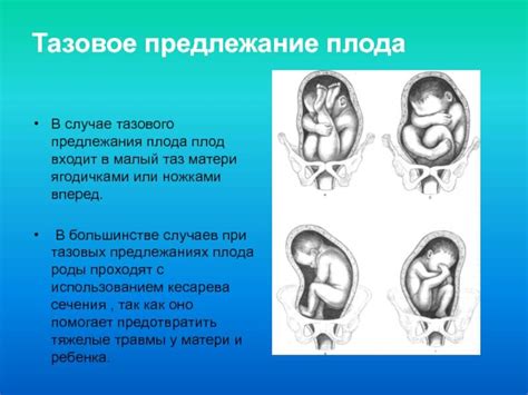 Продольное предлежание головное: особенности и характеристики