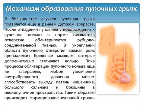 Пупочная инфекция: основные причины