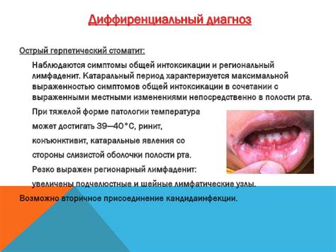 Роль микроорганизмов в развитии постоянного воспаления полости рта у детей