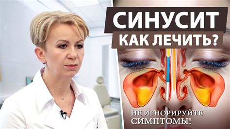Синусит