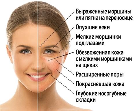 Суть глютенового лица
