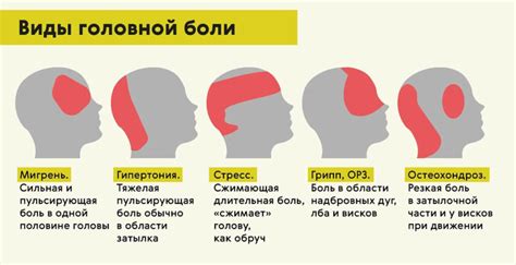 Типы головной боли