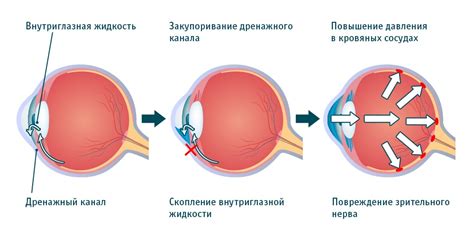 Факторы, влияющие на глазное давление