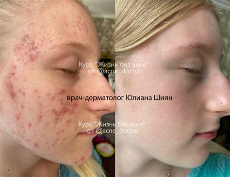  Медицинская помощь и профессиональное лечение проблем с кожей
