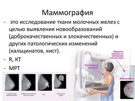 Взаимосвязь между маммографией и флюорографией: роль дополнительных обследований
