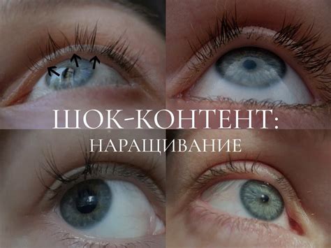 Влияние генетики на срок появления ресниц