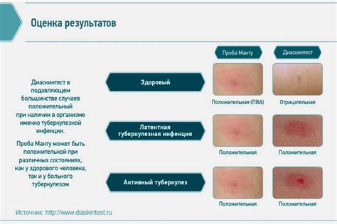 Влияние диаскин-теста на потребление конфет