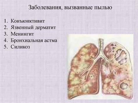 Влияние описторхоза на здоровье человека