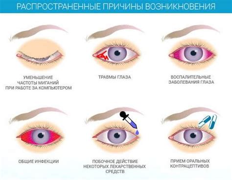 Влияние сухости глаз на повседневную жизнь