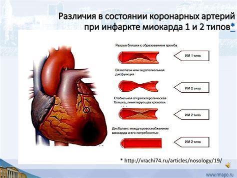 Внезапная смерть