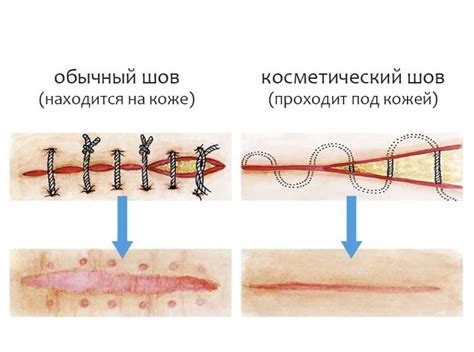 Возможности и ограничения при снятии швов в поликлинике