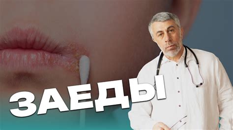 Заеды у детей: 5 эффективных способов избавления