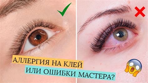 Как избежать повреждения собственных ресниц