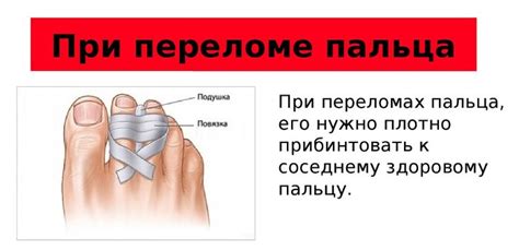 Как обеспечить первую помощь при переломе мизинца на ноге